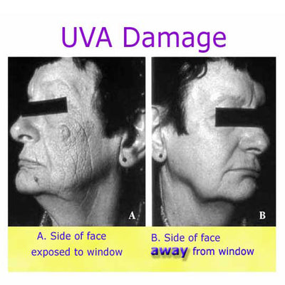 UVA Skin Damage Sun Exposure Via Window - Hidden Sources Of Aging